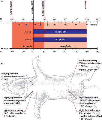 Comparison of Hemodynamic Support by Impella vs. Peripheral Extra-Corporeal Membrane Oxygenation: A Porcine Model of Acute Myocardial Infarction